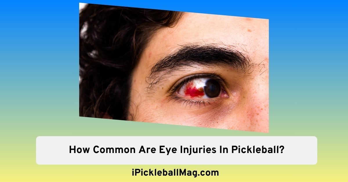 Eye Injuries in Pickleball – How Common They’re?
